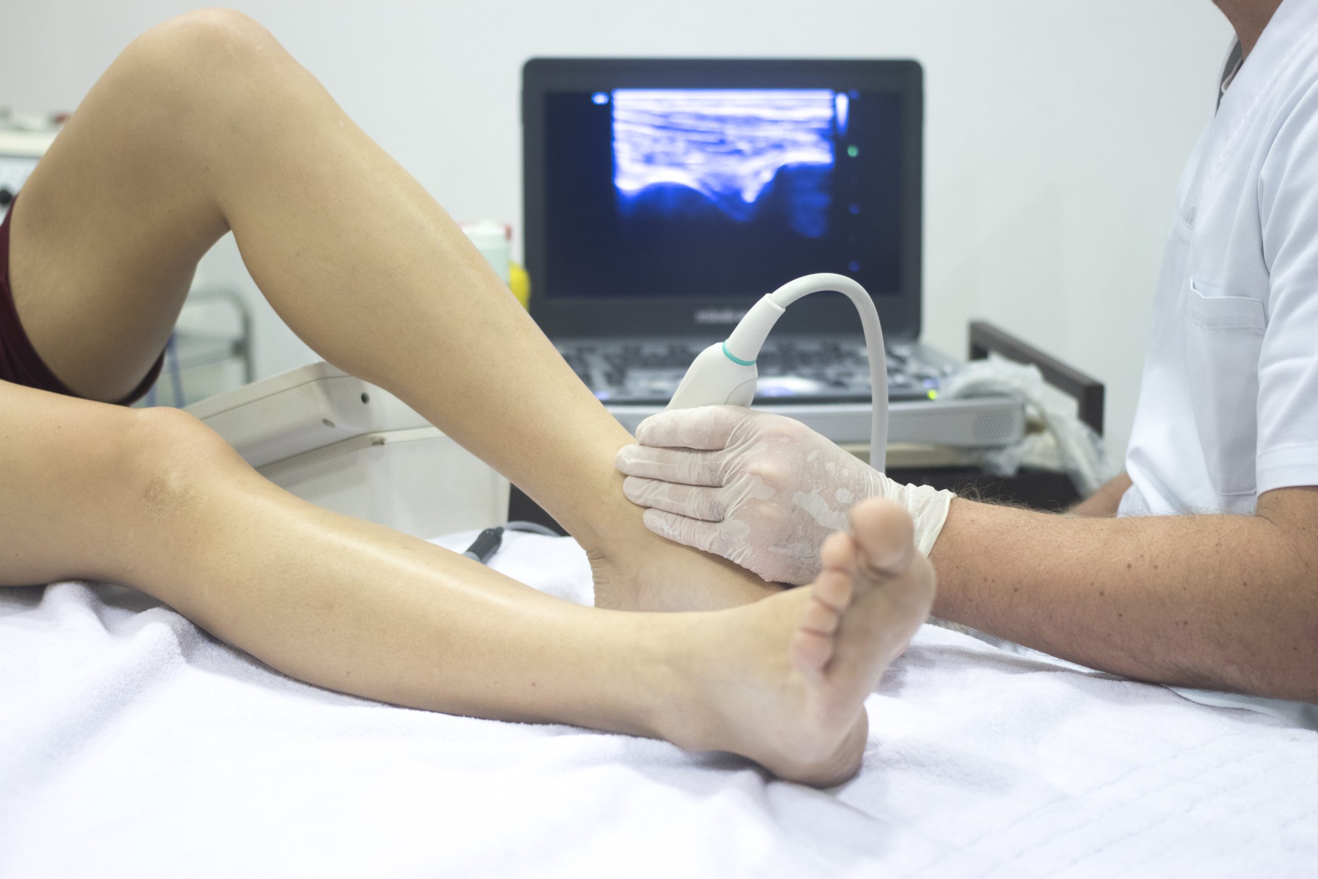 Venöz Renkli Doppler Ultrason Nedir ve Atardamar İncelemesi
